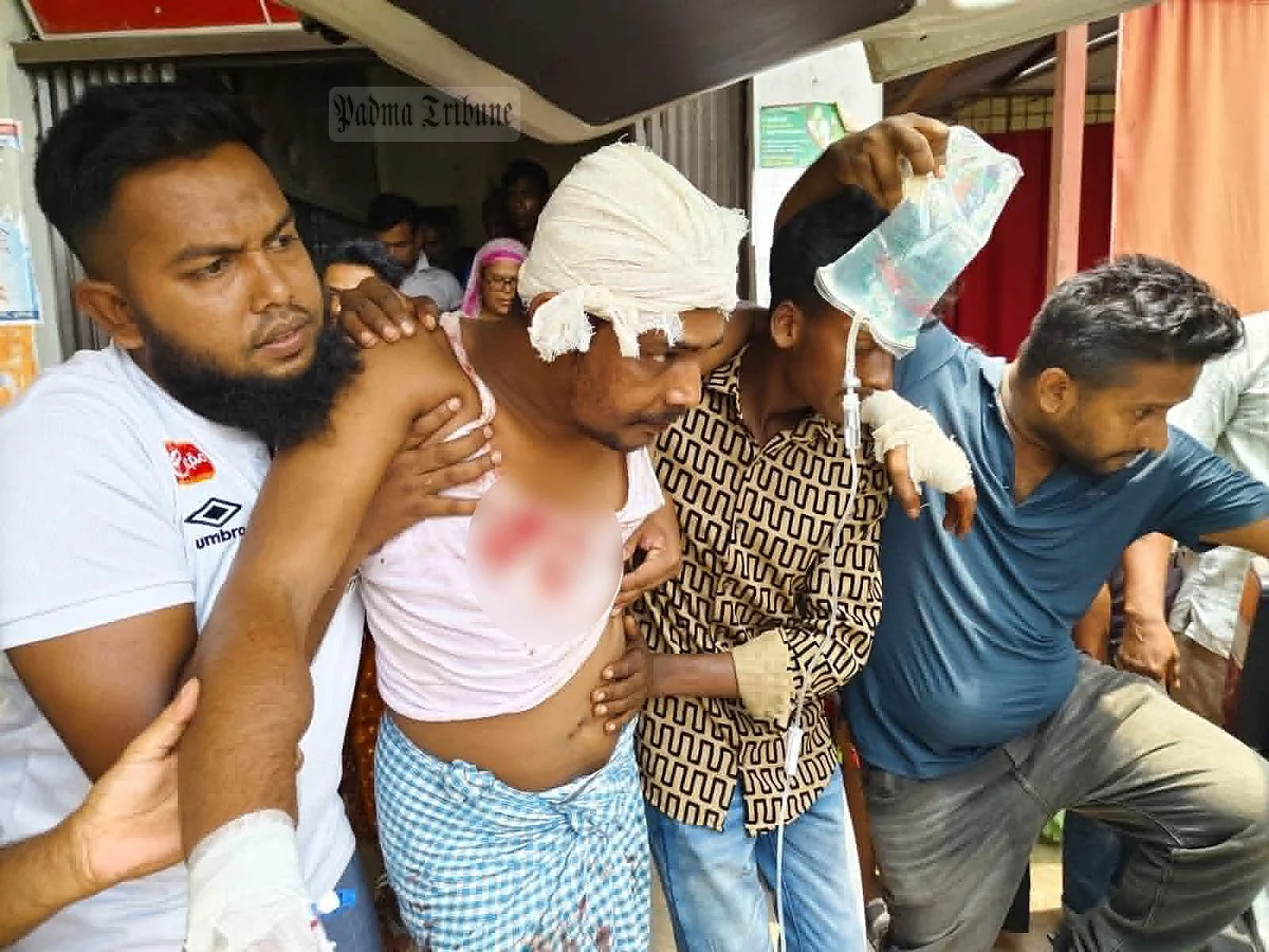 কুমারখালী পৌর ভবনে যুবলীগ নেতার ভাইকে কুপিয়ে জখম